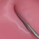 Image du produit suivant