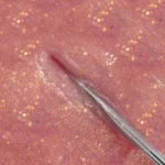 Image du produit précédent